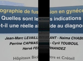 Echographie de fusion en gynécologie Echographie de fusion en gynécologie
