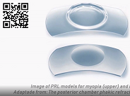 Edited Film A Sneaky IOL