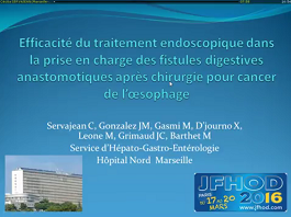 Efficacité du traitement endoscopique dans la prise en charge des fistules digestives anastomotiques après chirurgie pour cancer de l'oesophage