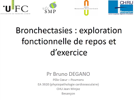 EFR de repos et exercice