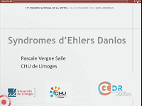 Ehler-Danlos Ehler-Danlos