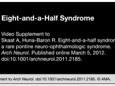 Eight-and-a-Half Syndrome Eight-and-a-Half Syndrome