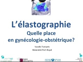 Elastographie : quelle place en gynécologie-obstétrique? Elastographie : quelle place en gynécologie-obstétrique?