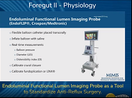 Endoluminal Functional Lumen Imaging Probe as a Tool to Standardize Anti-Reflux Surgery Endoluminal Functional Lumen Imaging Probe as a Tool to Standardize Anti-Reflux Surgery