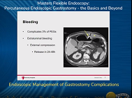 Endoscopic Management of Gastrostomy Complications