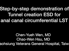 Endoscopic submucosal dissection for anal canal circumferential lateral spreading tumour Endoscopic submucosal dissection for anal canal circumferential lateral spreading tumour