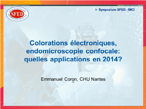 Endoscopie et MICI colorations electroniques endomicroscopie confoncale