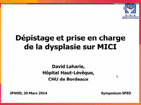 Endoscopie et MICI - Dépistage et prise en charge de la dysplasie