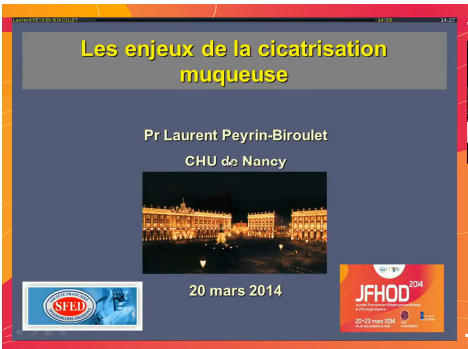 Endoscopie et MICI - Les enjeux de la cicatrisation muqueuse