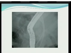 Endoscopy For Surgeons PG: Basics Of ERCP For Surgeons
