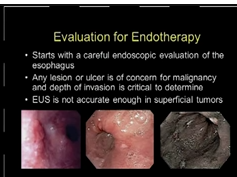 Endoscopy For Surgeons PG: Endoscopic Treatment Of Barretts