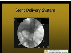 Endoscopy For Surgeons PG: Endoscopic Treatment Of Complications After GI Surgery Endoscopy For Surgeons PG: Endoscopic Treatment Of Complications After GI Surgery