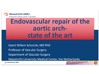Endovascular repair of the aortic arch Endovascular repair of the aortic arch