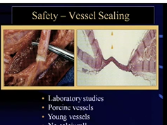 Energy in the OR: What are the Risks? Energy in the OR: What are the Risks?