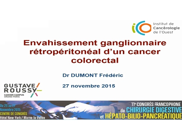 Envahissement ganglionnaire rétropéritonéal d'un cancer colorectal