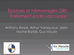 Epistaxis et hémorragies ORL Epistaxis et hémorragies ORL