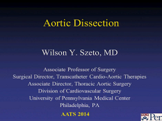 Etat cardiaque et prise de décision - Dissection aortique Etat cardiaque et prise de décision - Dissection aortique