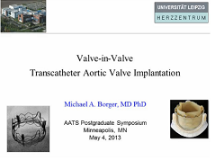 Etat cardiaque et prise de décision - Implantation valve-dans-valve de la valve aortique Etat cardiaque et prise de décision - Implantation valve-dans-valve de la valve aortique