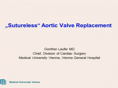 Etat cardiaque et prise de décision - Etat cardiaque et prise de décision -