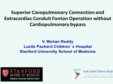 Etat congénital et prise de décision - Connection cavopulmonaire supérieure et opération de Fontan du conduit en extra-cardiaque sans contournement cardiopulmonaire Etat congénital et prise de décision - Connection cavopulmonaire supérieure et opération de Fontan du conduit en extra-cardiaque sans contournement cardiopulmonaire
