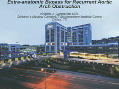 Etat congénital et prise de décision - Contournement extra-anatomique pour l'obstruction de la crosse aortique récurrente Etat congénital et prise de décision - Contournement extra-anatomique pour l'obstruction de la crosse aortique récurrente