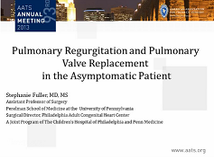 Etat congénital et prise de décision - Tétralogie de Fallot et remplacement de la valve pulmonaire : Timing et techniques sur le patient asymptomatique