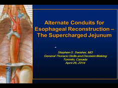 Etat thoracique et prise de décision - Conduits alternatifs à la reconstruction oesophagienne : Le jéjunum superalimenté Etat thoracique et prise de décision - Conduits alternatifs à la reconstruction oesophagienne : Le jéjunum superalimenté