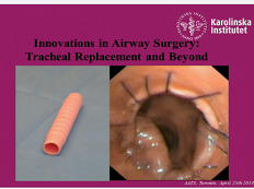 Etat thoracique et prise de décision - Innovation dans la chirurgie des voies respiratoires : Remplacement trachéal et au-delà Etat thoracique et prise de décision - Innovation dans la chirurgie des voies respiratoires : Remplacement trachéal et au-delà