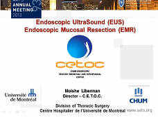 Etat thoracique et prise de décision - Ultrasons Oesophagiens (EUS) / Résection endoscopique des muqueuses (EMR)