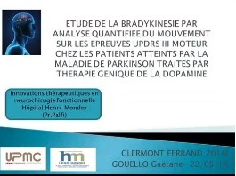 Etude de la Bradykinesie par analyse quantifiée du mouvement sur les épreuves UPDRS III moteur chez les patients parkinsoniens traités par thérapie génique à la dopamine