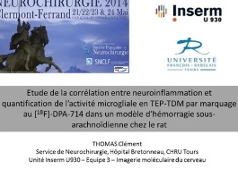 Etude de la neuroinflammation en TEP-TDM dans un modèle d'hémorragie sous-arachnoïdienne chez le rat Etude de la neuroinflammation en TEP-TDM dans un modèle d'hémorragie sous-arachnoïdienne chez le rat