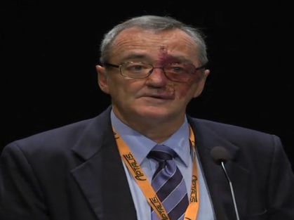 European Pancreatic Club 2013 - The contribution of inflammation to the progression of pancreatic ductal adenocarcinoma European Pancreatic Club 2013 - The contribution of inflammation to the progression of pancreatic ductal adenocarcinoma