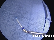 Eustachian Tube Balloon Dilation