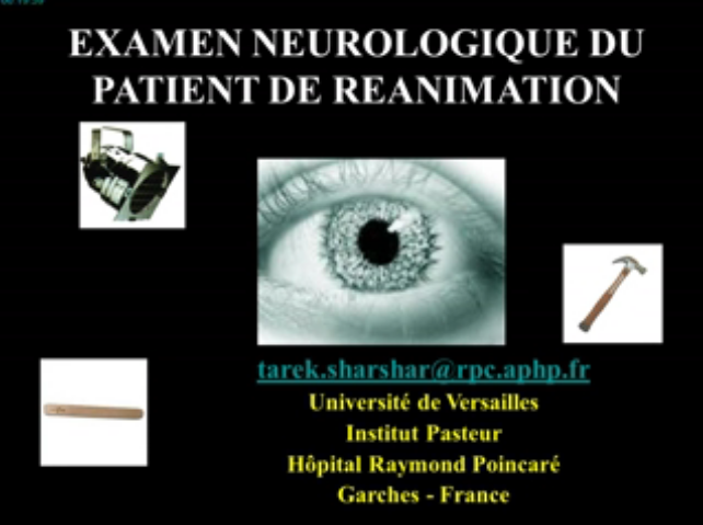 Evaluation du pronostic neurologique - L'examen clinique et ses limites - 2015 Evaluation du pronostic neurologique - L'examen clinique et ses limites - 2015
