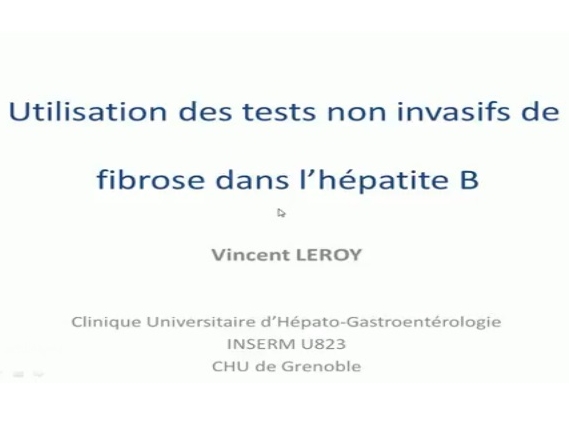 Evaluation non invasive de la fibrose dans l'hépatite B