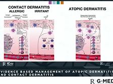 Evidence based management of atopic dermatitis and contact dermatitis