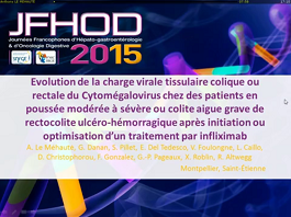 Evolution de la charge virale tissulaire colique ou rectale de cytomégalovirus chez des patients en poussée modérée à sévère ou colite aiguë grave de rectocolite ulcéro-hémorragique après initiation ou optimisation d'un traitement par infliximab