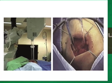 Evolution of Surgical Care in Breast Cancer