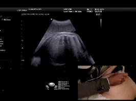 Examen de l'estomac et de la vessie foetal : aspect fonctionnel Examen de l'estomac et de la vessie foetal : aspect fonctionnel