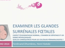 Examiner les glandes surrénales foetales Examiner les glandes surrénales foetales