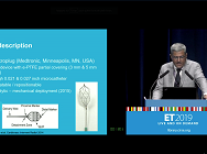 Expanding embolisation options with the MVP Micro Vascular Plug System