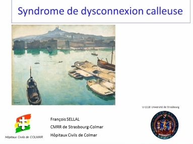 Exploration clinique d'un syndrome du corps calleux