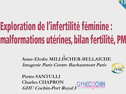 Exploration de la fertilité (Malfo utérine Bilan fertilité, PMA)