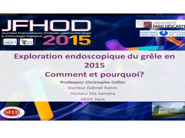 Exploration endoscopique du grêle : comment et pourquoi ?