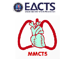 External stent (VEST) for saphenous vein grafts in coronary artery bypass grafting External stent (VEST) for saphenous vein grafts in coronary artery bypass grafting