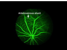 Eye Findings in a Mouse Model Mimicking EPAS1 Gain-of-Function Mutation Syndrome Eye Findings in a Mouse Model Mimicking EPAS1 Gain-of-Function Mutation Syndrome