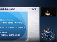 Eye's Injury by Paintball