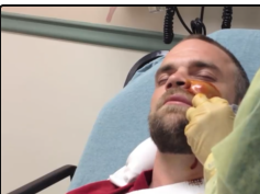 facial abscess follow up (complete)