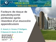 Facteurs de risque de Pseudomyxome Péritonéal Malin après résection d’un mucocèle appendiculaire. Résultats d’une étude monocentrique rétrospective