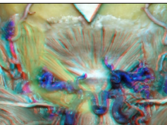 Far Lateral Approach and Jugular Foramen - Part 1 of 2